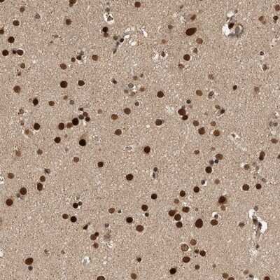 Immunohistochemistry-Paraffin: CPSF2 Antibody [NBP1-82910]