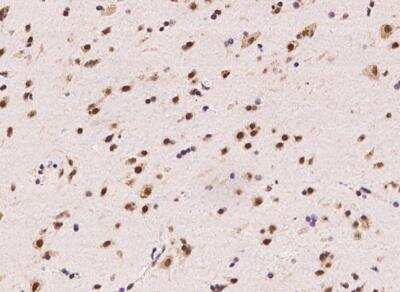 Immunohistochemistry-Paraffin: CPSF2 Antibody [NBP3-06492]