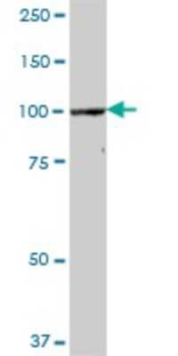 Western Blot: CPSF2 Antibody [H00053981-B01P]