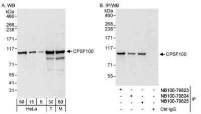 Western Blot: CPSF2 Antibody [NB100-79823]