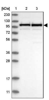 Western Blot: CPSF2 Antibody [NBP1-82910]
