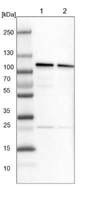 Western Blot: CPSF2 Antibody [NBP1-82910]