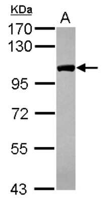 Western Blot: CPSF2 Antibody [NBP2-15988]