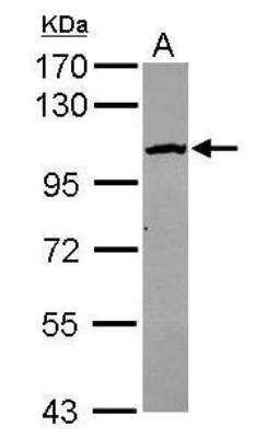 Western Blot: CPSF2 Antibody [NBP2-15989]