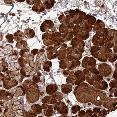 Immunohistochemistry-Paraffin: CPSF4 Antibody [NBP2-13868]