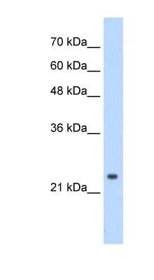 Western Blot: CPSF4 Antibody [NBP1-57114]