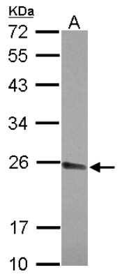 Western Blot: CPSF4 Antibody [NBP2-15990]