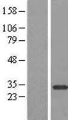 Western Blot: CPSF4 Overexpression Lysate [NBL1-09448]