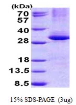 SDS-PAGE: Recombinant Human CPSF4 His Protein [NBP2-22783]