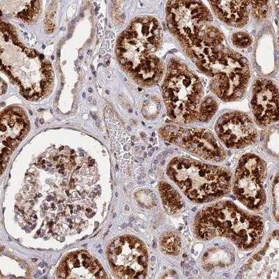 Immunohistochemistry-Paraffin: CPSF4L Antibody [NBP1-94159]