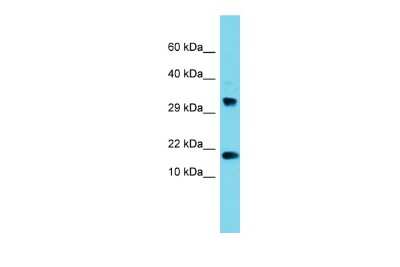 Western Blot: CPSF4L Antibody [NBP2-82756]