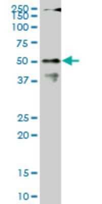 Western Blot: CPSF6 Antibody (1C5) [H00011052-M07]