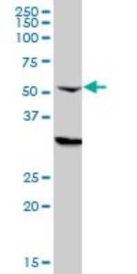 Western Blot: CPSF6 Antibody (3F11) [H00011052-M10]