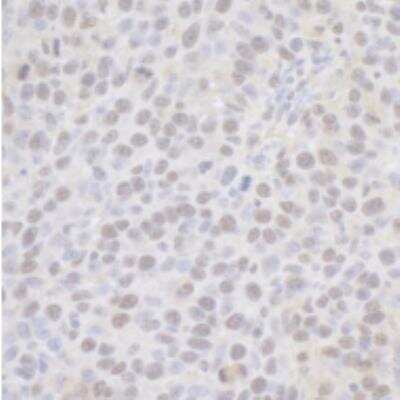 Immunohistochemistry-Paraffin: CPSF6 Antibody [NB100-61596]