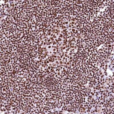 Immunohistochemistry-Paraffin: CPSF6 Antibody [NBP1-85676]