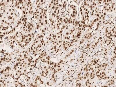 Immunohistochemistry-Paraffin: CPSF6 Antibody [NBP2-99189]