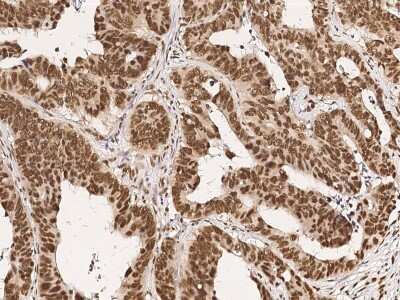 Immunohistochemistry-Paraffin: CPSF6 Antibody [NBP2-99189]