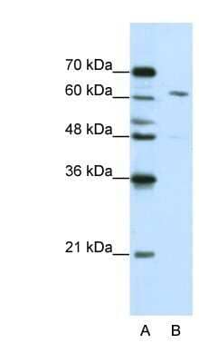 Western Blot: CPSF6 Antibody [NBP1-57541]