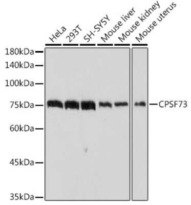 Western Blot: CPSF73 Antibody (4S4P2) [NBP3-16095]