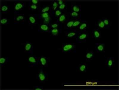 Immunocytochemistry/ Immunofluorescence: CPSF73 Antibody (6E6) [H00051692-M01]