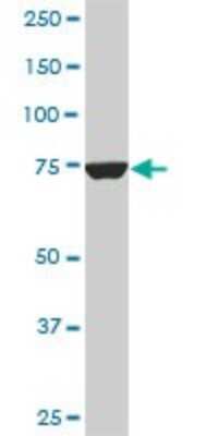 Western Blot: CPSF73 Antibody (6E6) [H00051692-M01]