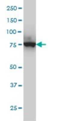 Western Blot: CPSF73 Antibody (6E6) [H00051692-M01]