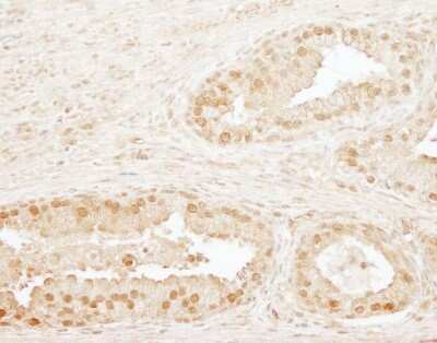 Immunohistochemistry-Paraffin: CPSF73 Antibody [NB100-57528]