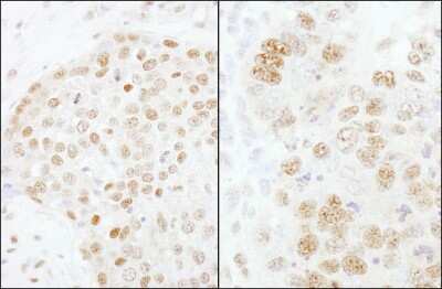 Immunohistochemistry-Paraffin: CPSF73 Antibody [NB100-57529]