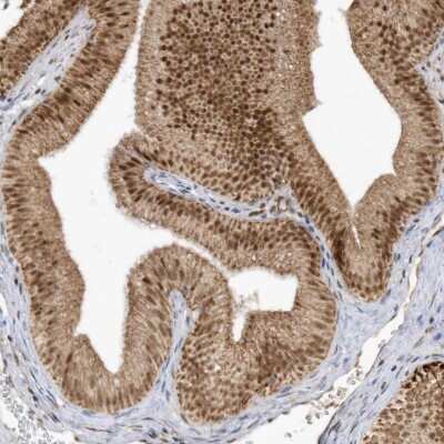 Immunohistochemistry-Paraffin: CPSF73 Antibody [NBP1-85476]