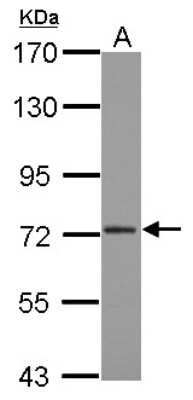 Western Blot: CPSF73 Antibody [NBP2-15992]