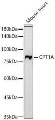 Western Blot: CPT1A Antibody (3M6E9) [NBP3-16072]