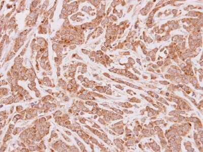 Immunohistochemistry-Paraffin: CPT1A Antibody [NBP2-15993]