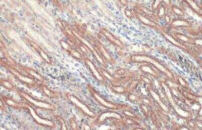 Immunohistochemistry-Paraffin: CPT1A Antibody [NBP2-15993]