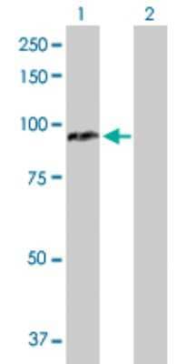 Western Blot: CPT1A Antibody [H00001374-D01P]