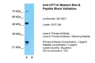Western Blot: CPT1A Antibody [NBP1-59608]