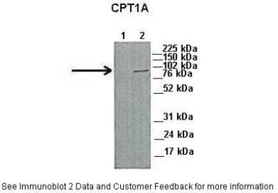 Western Blot: CPT1A Antibody [NBP1-59608]