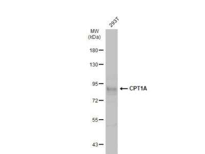 Western Blot: CPT1A Antibody [NBP2-15993]