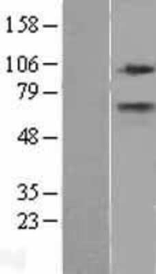 Western Blot: CPT1A Overexpression Lysate [NBL1-09449]