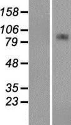 Western Blot: CPT1A Overexpression Lysate [NBP2-09778]