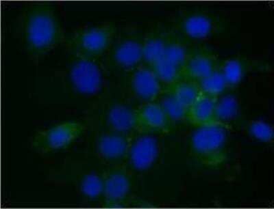 Immunohistochemistry: CPT1B Antibody [NBP1-59576]