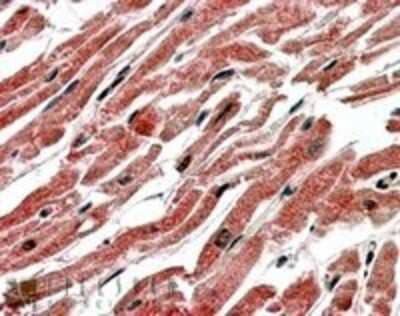 Immunohistochemistry-Paraffin: CPT1B Antibody [NB100-1057]