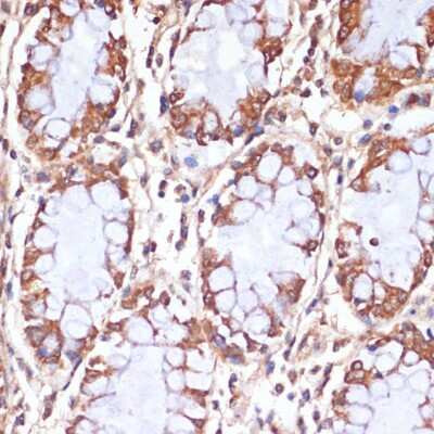 Immunohistochemistry-Paraffin: CPT1B Antibody - BSA Free [NBP2-92666]