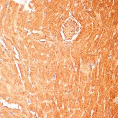 Immunohistochemistry-Paraffin: CPT1B Antibody - BSA Free [NBP2-92666]