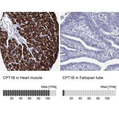 Immunohistochemistry-Paraffin: CPT1B Antibody [NBP3-17029]