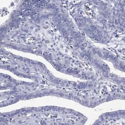 Immunohistochemistry-Paraffin: CPT1B Antibody [NBP3-17029]