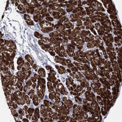 Immunohistochemistry-Paraffin: CPT1B Antibody [NBP3-17029]