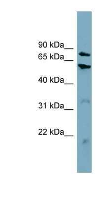 Western Blot: CPT1B Antibody [NBP1-59576]