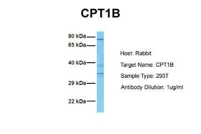 Western Blot: CPT1B Antibody [NBP1-59576]