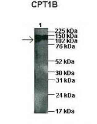 Western Blot: CPT1B Antibody [NBP1-59576]