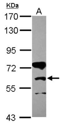 Western Blot: CPT1B Antibody [NBP2-15994]